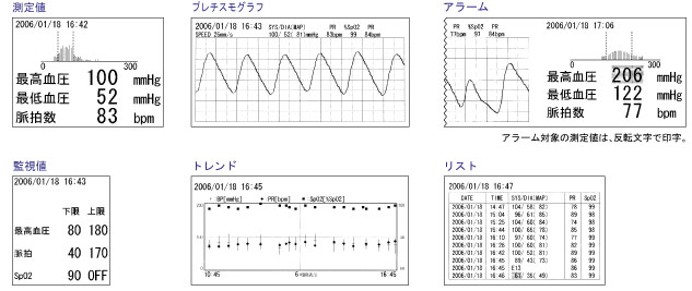 生物識別信息監視器TM  -  2571 / TM  -  2572（重要盒）打印打印示例圖像